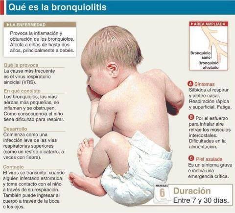 Infografía de bebé y resumen de bronquiolitis